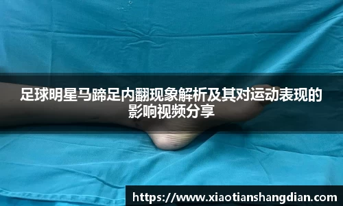 足球明星马蹄足内翻现象解析及其对运动表现的影响视频分享